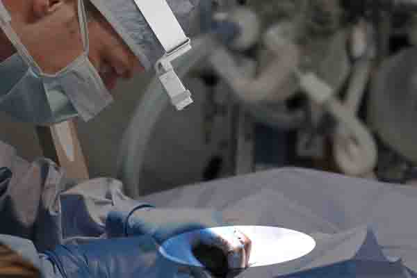 醫用頭燈,深圳工業設計